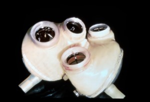 Biomedical Engineers helped create the Jarvik artificial heart